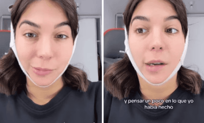 Joven impacta en la red al enseñar la parálisis facial que sufrió tras cirugía estética