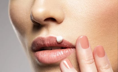 ¿Cómo tratar el herpes labial? Sigue estos consejos