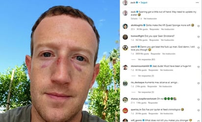 Mark Zuckerberg aparece con moretones en la cara: 'el combate se salió un poco de control'