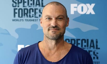 Brian Austin Green, ex de Megan Fox, tuvo síntomas de un derrame cerebral por culpa de una dieta