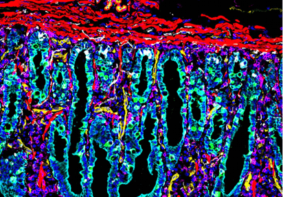 Hallan una llave que ataca a los microbios en las células infectadas