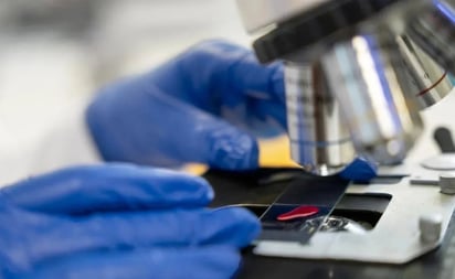 'Prueba de fuego' para la cura del VIH con tecnología CRISPR: se enfrenta a su test de seguridad