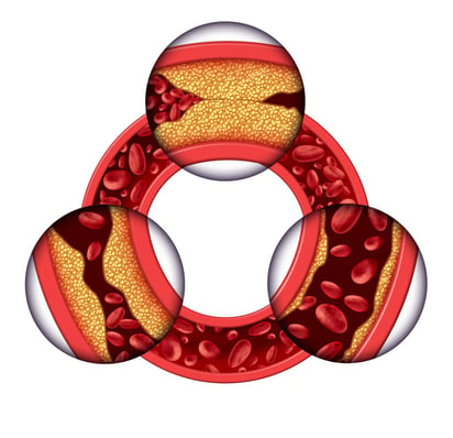 Corazón y arterias: ¿Qué les sucede a medida que envejeces?