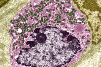 Una nueva explicación sobre COVID-19 persistente: ¿Niveles bajos de serotonina?