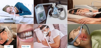 CPAP ayuda a reducir los riesgos cardíacos - pero hay que usarlo