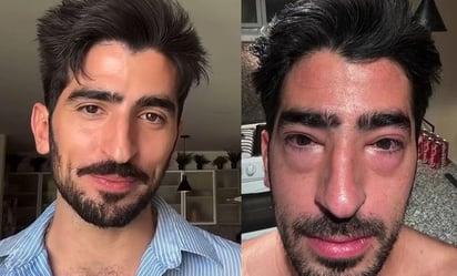 Influencer Jezzini preocupa a fans tras aparecer con los ojos hinchados; ¿qué le pasó?