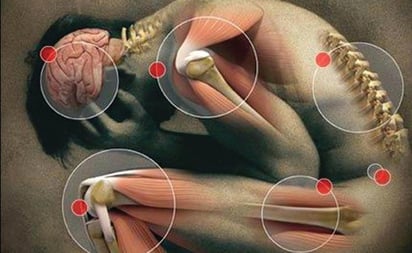 ¿El invierno te enferma? 30% de las personas en México padecen dolor crónico en estas fechas