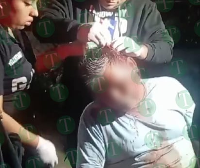 Le abren la cabeza de un tubazo en la parranda