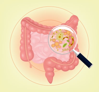 ¿Enfermedad intestinal inflamatoria y ácido acetilsalicílico en embarazo?