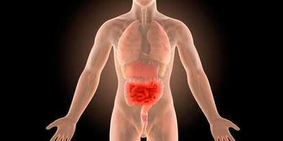 El riesgo de la enfermedad de Crohn y la colitis varían según el origen étnico y el género