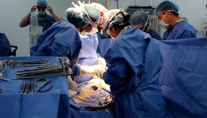 Extirpan un tumor de más de 50 kilos del abdomen de una mujer en Italia