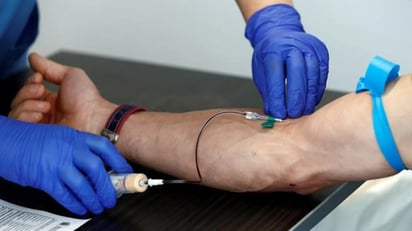 Un nuevo análisis de sangre para detectar el alzhéimer