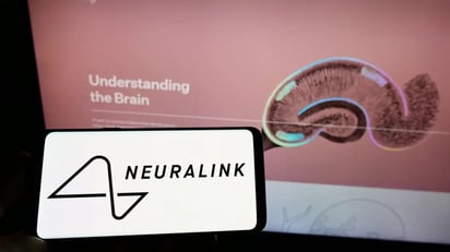 La empresa de implantes cerebrales de Elon Musk, Neuralink, multada por infracción de “materiales peligrosos”