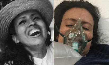 'Ya no soy yo': la pesadilla de la colombiana que lleva más de tres años con Covid