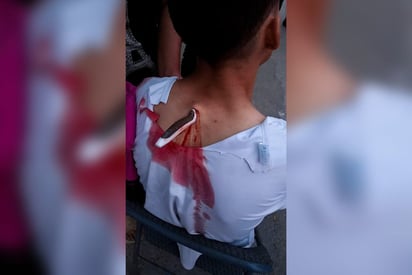 Joven sigue grave tras ser apuñalado en pelea