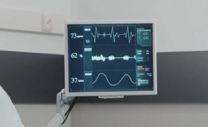 Cofepris autoriza primer software de alta tecnología para tratamiento de infarto al miocardio