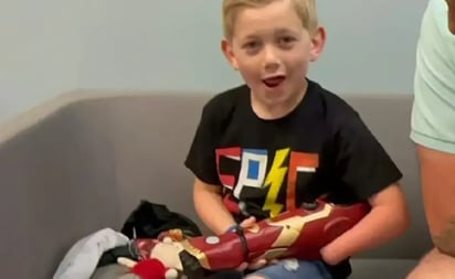 Niño recibe brazo biónico: siempre soñó con ser un superheroe