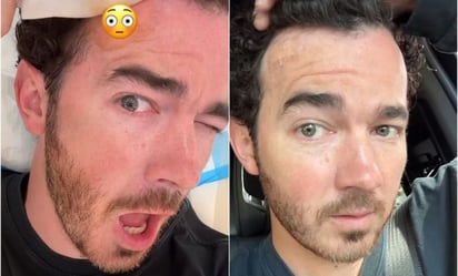 Lunar de Kevin Jonas, de los Jonas Brothers, resultó ser un tumor maligno