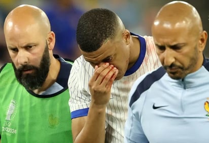 Mbappé se fractura la nariz, regresa a la concentración y jugará con máscara