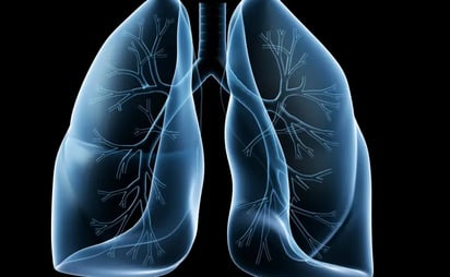 SALUD: La gravedad de la enfermedad pulmonar intersticial es altamente variable