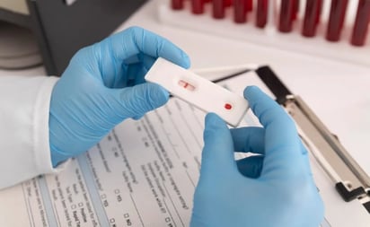 SALUD: La implementación del Panbio VIH Self Test está regulada por la Norma Oficial Mexicana