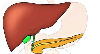 SALUD: El hígado graso es una enfermedad caracterizada por la acumulación de grasa en las células hepáticas