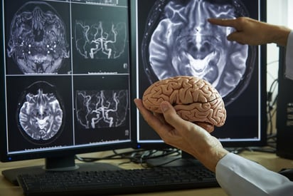 SALUD: Los adultos con fobias tienen una estructura cerebral significativamente diferente