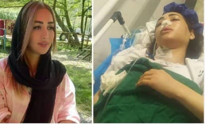 Por no llevar hiyab, mujer tiroteada por agentes en Irán queda paralítica