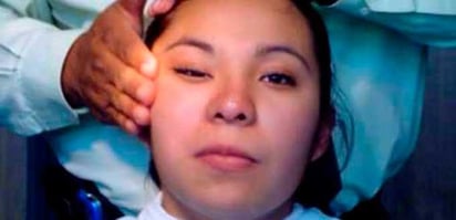 Piedras Negras : El sector salud advierte sobre la parálisis facial por cambios bruscos de temperatura durante el calor.