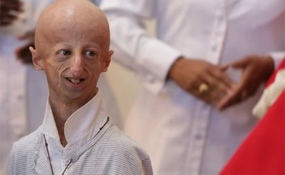 SALUD: El científico Sammy Basso, dedicó su vida al estudio de la progeria