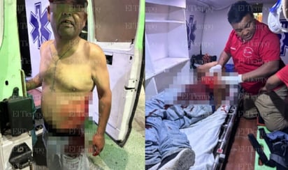 Policiaca : Hombre en estado crítico tras ser apuñalado por \'El Payo\' en Ciudad Frontera