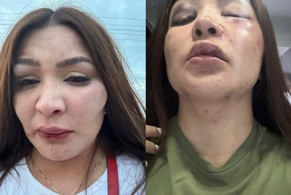 Dueña de spa es agredida por su pareja y teme por su vida