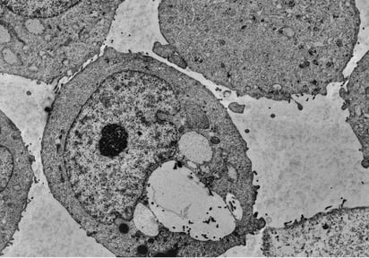 Un suplemento de vitamina K frena el cáncer de próstata en ratones