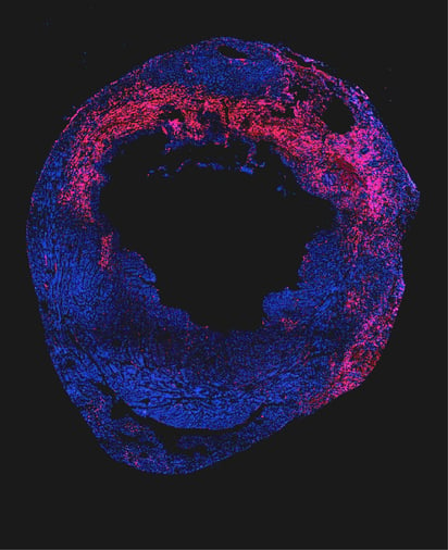 ¿Se puede reparar el corazón tras un infarto? esta proteína puede tener la clave