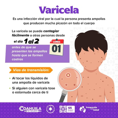 Salud : Recomendaciones sobre la varicela por parte de la Jurisdicción Sanitaria Uno