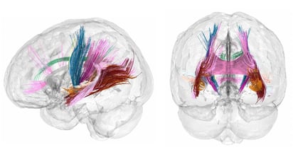 SALUD: Investigadores de Mount Sinai han descubierto que el cerebro actualiza y conecta recuerdos