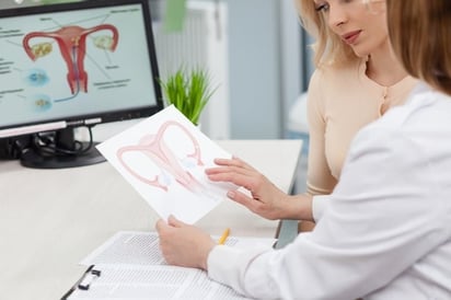 SALUD: Las mujeres que tienen fibromas uterinos o endometriosis son más propensas a contraer cáncer

