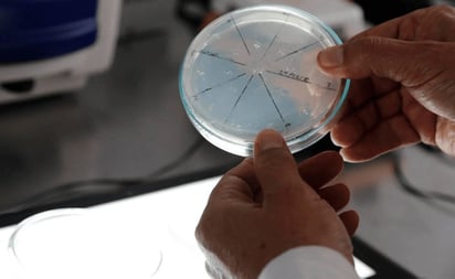 SALUD: La resistencia se presenta cuando, ante un proceso infeccioso generado por algún virus, se da un tratamiento innecesario 