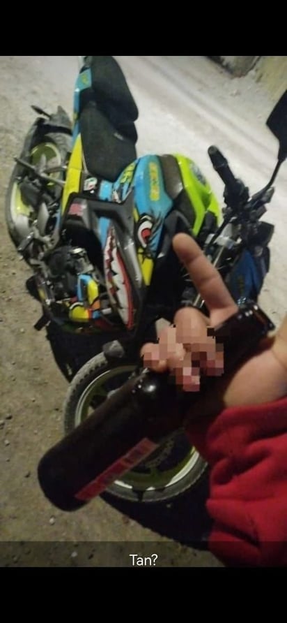 policiaca: Los lesionados fueron llevados al hospital General Amparo Pape de Benavides.