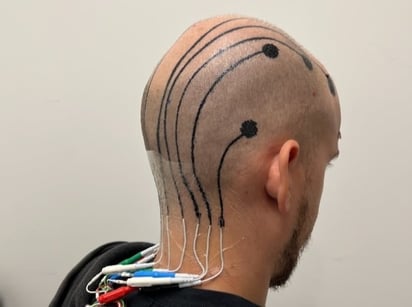 SALUD: Un nuevo tatuaje temporal podría facilitar el seguimiento de la actividad cerebral

