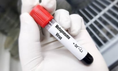 Metapneumovirus : Aunque hay un aumento de casos, no hay motivo de alarma global.