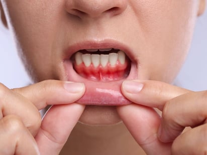 ENFERMEDADES ENFERMEDADES