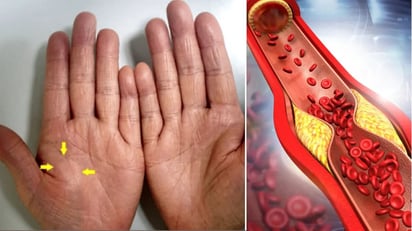 ENFERMEDADES ENFERMEDADES