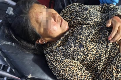 seguridad: Socorristas de GRUM la atienden de inmediato