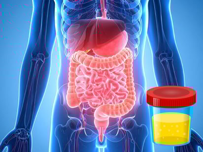BUN: ¿Cuándo un nivel alto podría revelar un daño en la función renal o hepático?