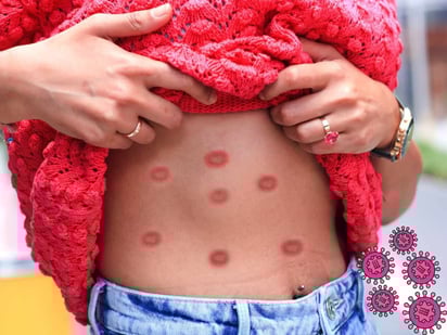 ENFERMEDADES ENFERMEDADES