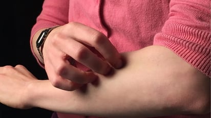 ENFERMEDADES ENFERMEDADES