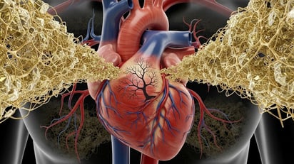 ENFERMEDADES ENFERMEDADES