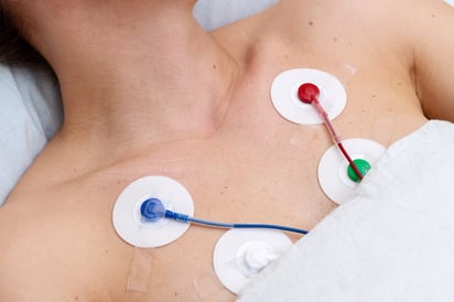Holter cardíaco: para qué sirve el estudio que registra el ritmo del corazón durante 24 horas