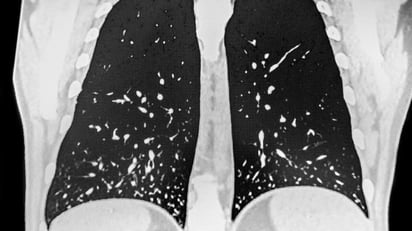 ENFERMEDADES ENFERMEDADES